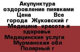 Акупунктура, оздоровление пиявками › Цена ­ 3 000 - Все города, Жуковский г. Медицина, красота и здоровье » Медицинские услуги   . Мурманская обл.,Полярный г.